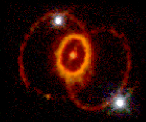 Supernova 1987A - HST